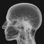 半ば強制的に受けた手術が殺人の原因！？　加害者が語り始めた事件の真相とは【ロボトミー殺人事件③】